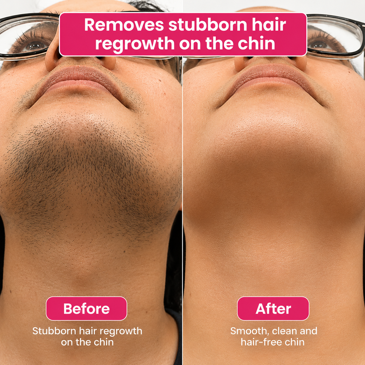 🔥LAST DAY 60% OFF Lunarlumi Hair Reduction Oil 60 ml – Permanent Hair Removal Oil