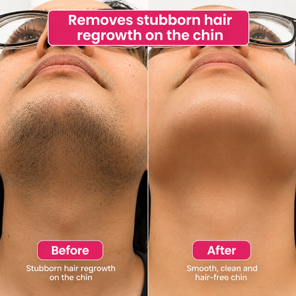 🔥LAST DAY 60% OFF Lunarlumi Hair Reduction Oil 60 ml – Permanent Hair Removal Oil